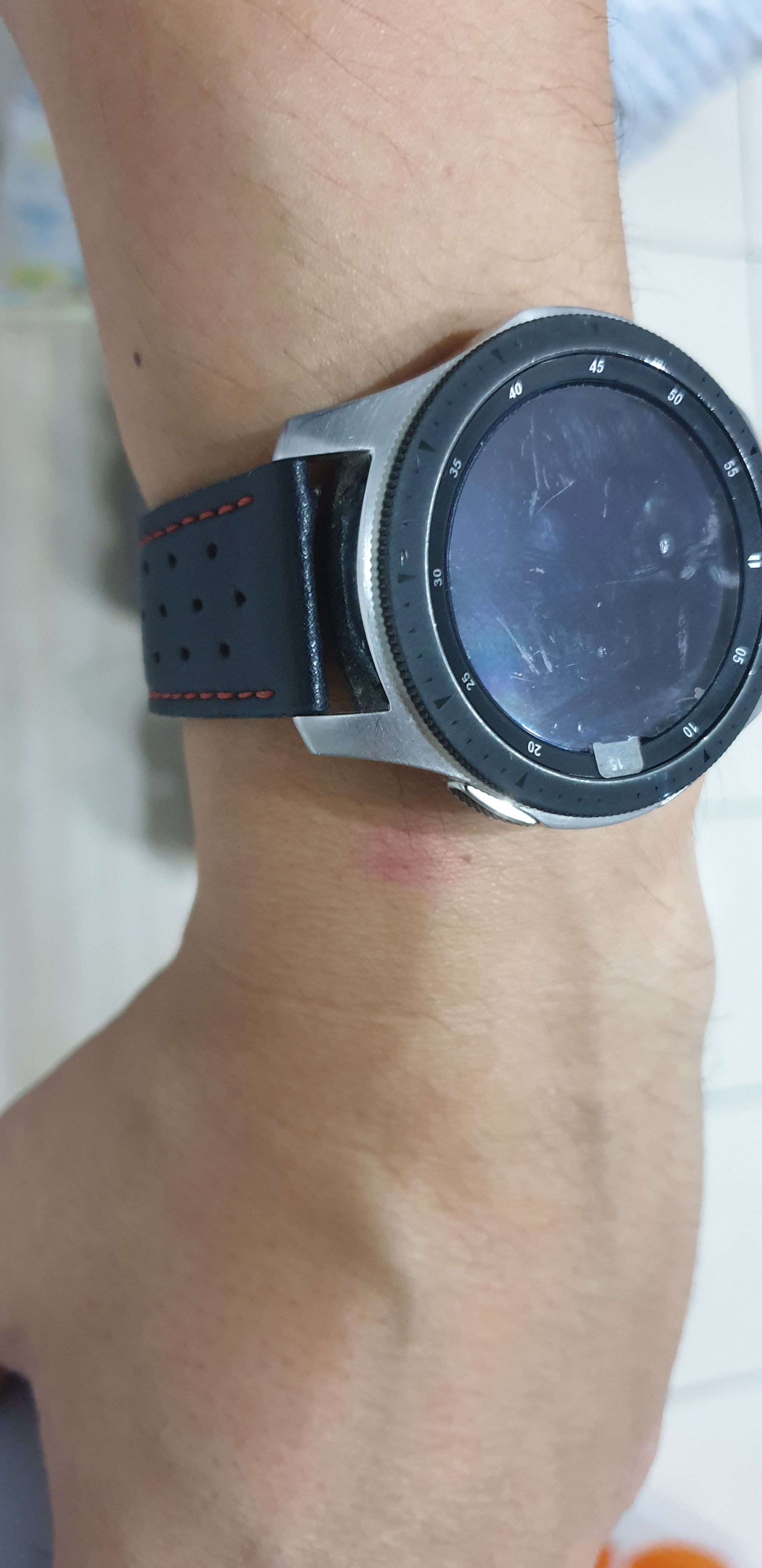 Rougeur sur la peau sous le capteur cardiaque de la Galaxy WATCH - Samsung  Community