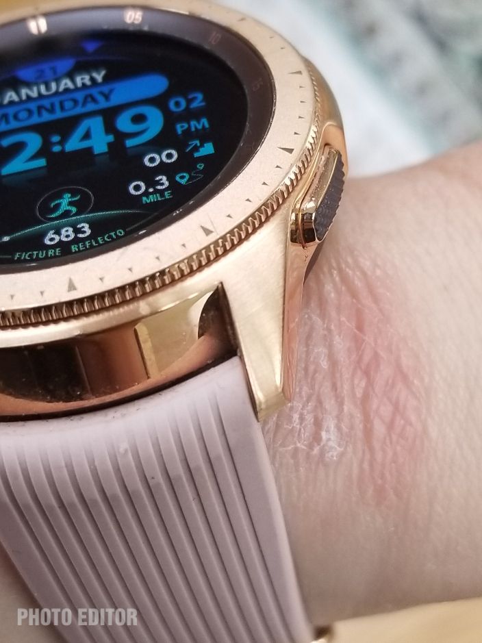 Samsung Galaxy Rose Gold 42 mm rash reaction  on 1.21.19