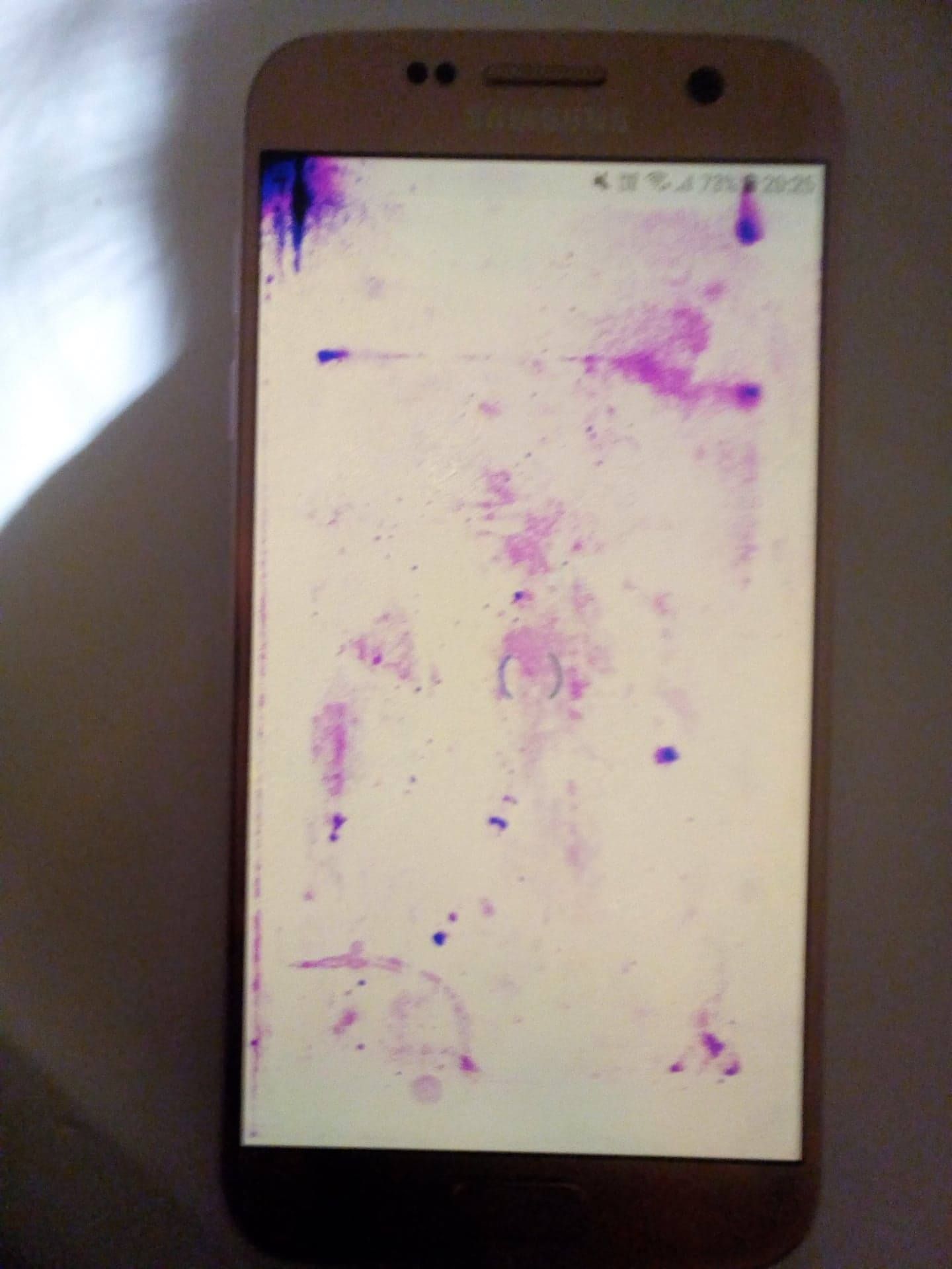 tâches violettes sur écran S7 - Samsung Community